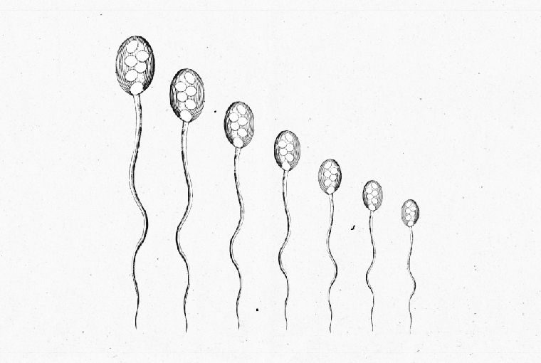 Semen Analysis Decoded